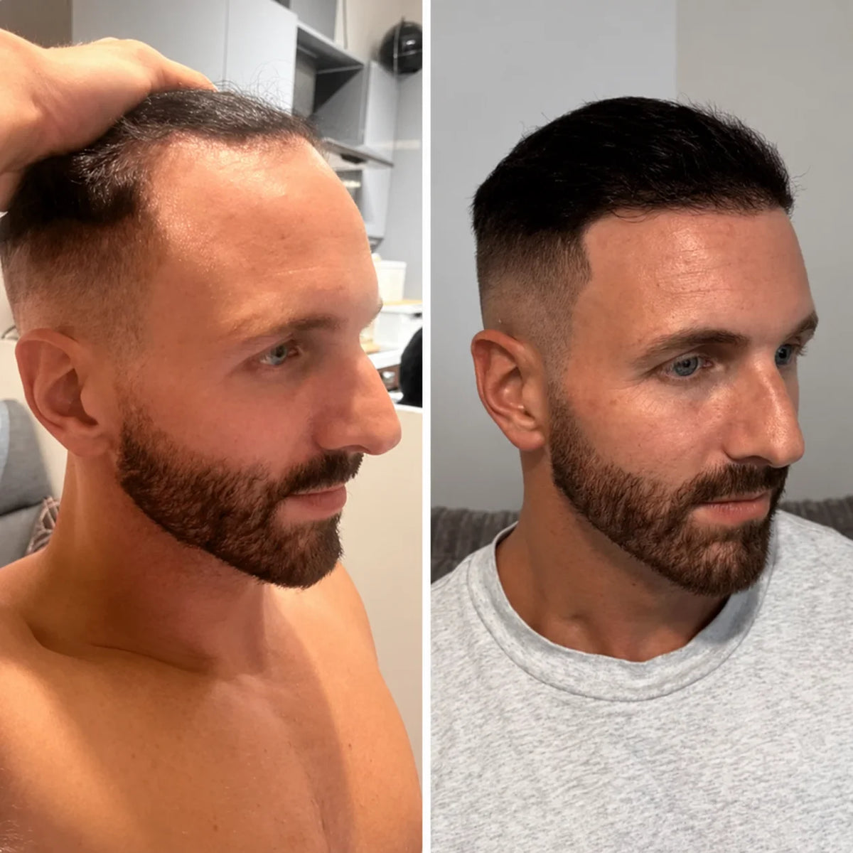 Hårväxtserum roll-on – för tunt hår