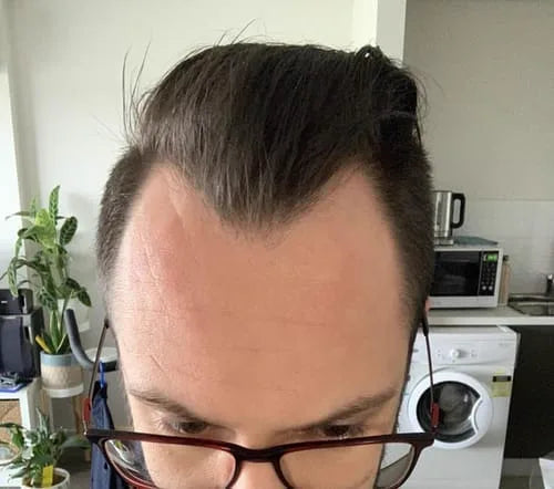 Kundbild – WADES hårväxtserum